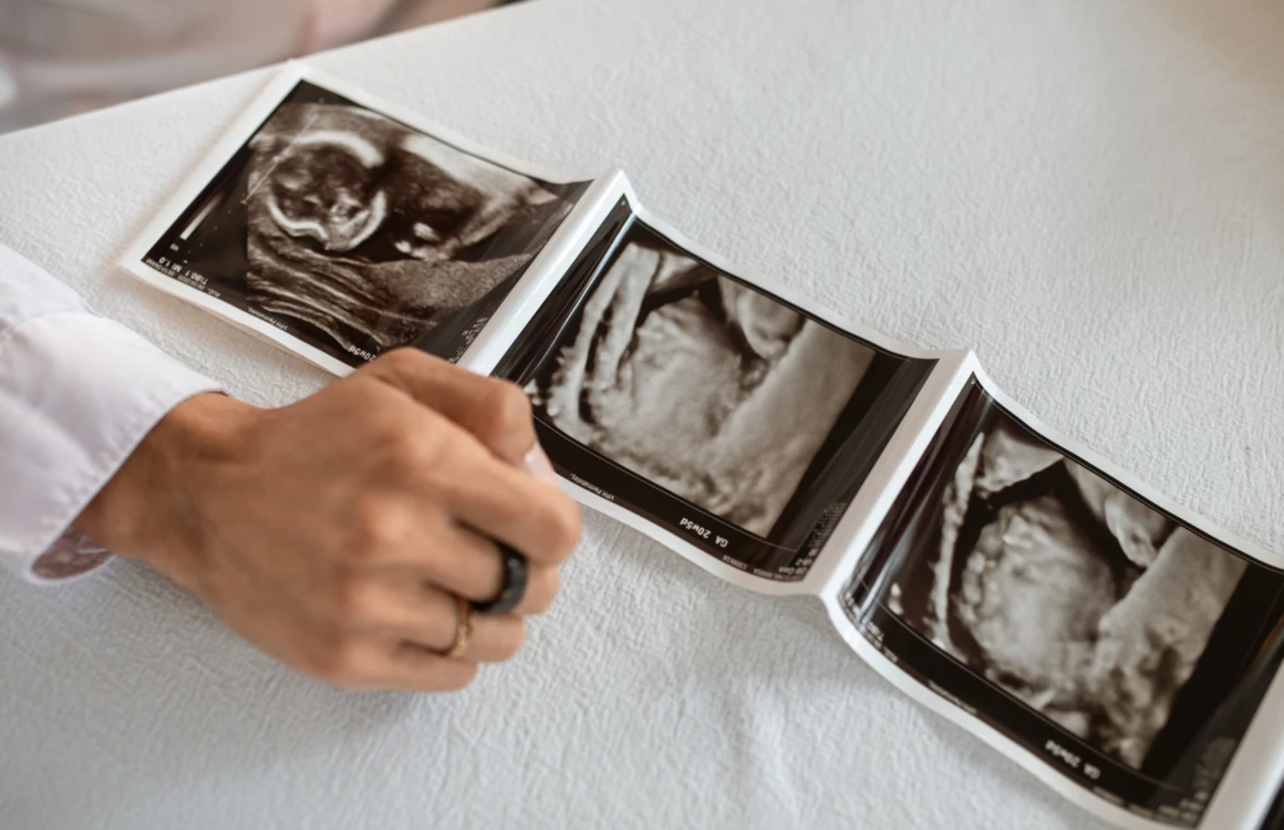 Rosa Scuro e Rosa Chiaro Giocoso Compleanno Migliore Amica Biglietto Pieghevole Klappkarten 1