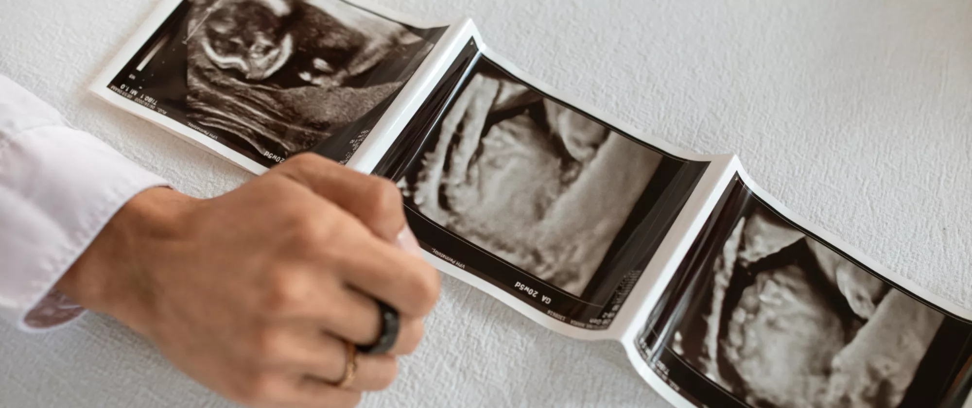 Rosa Scuro e Rosa Chiaro Giocoso Compleanno Migliore Amica Biglietto Pieghevole Klappkarten 1